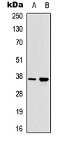 RAD51A (phospho-Tyr315) Antibody