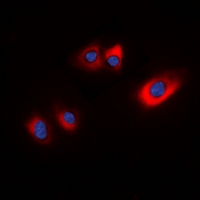 HSP20 (phospho-Ser16) Antibody