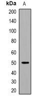 EEF1A (acetyl-Lys146) Antibody