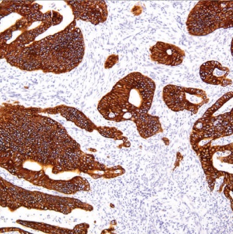 Cytokeratin 18 Antibody