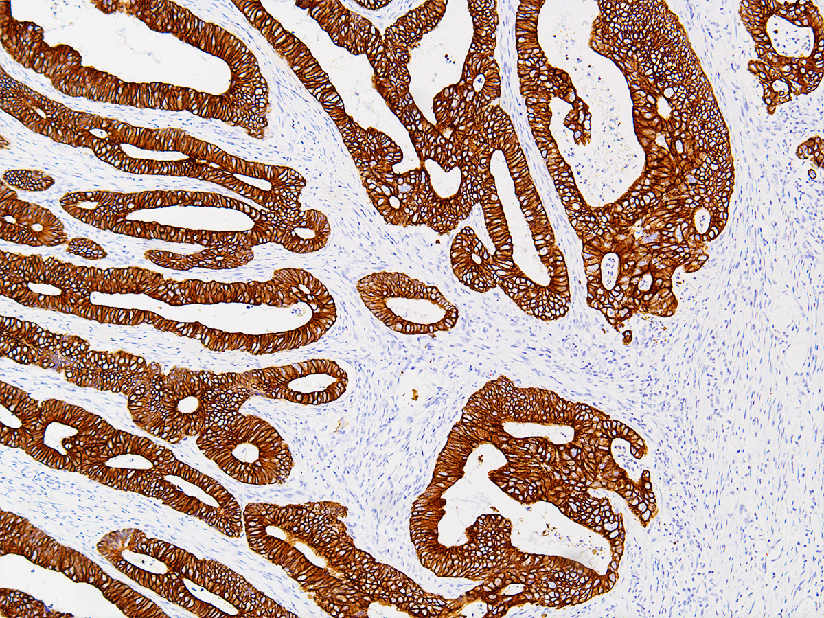 Cytokeratin 19 Antibody