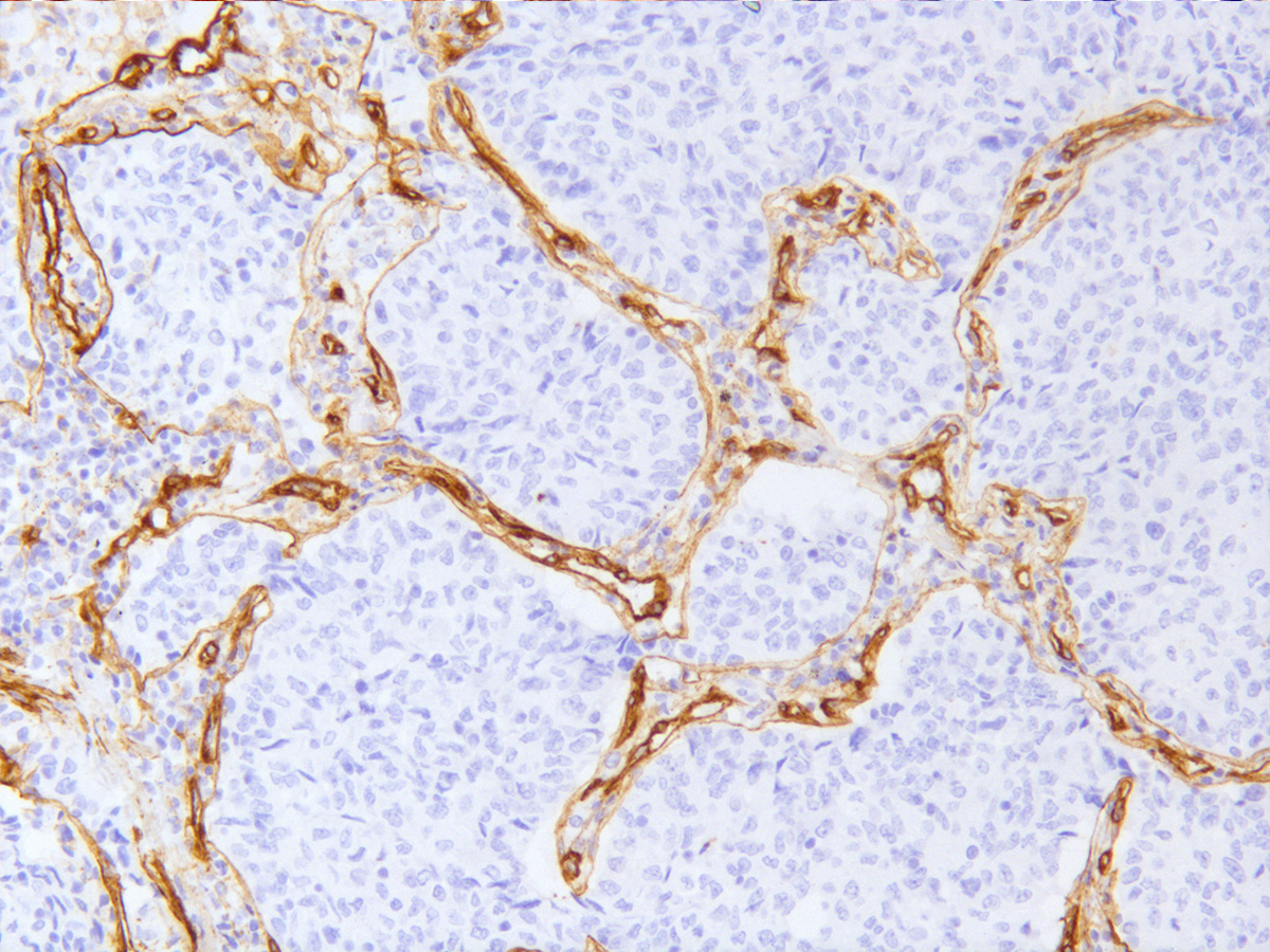 Collagen Type IV Antibody