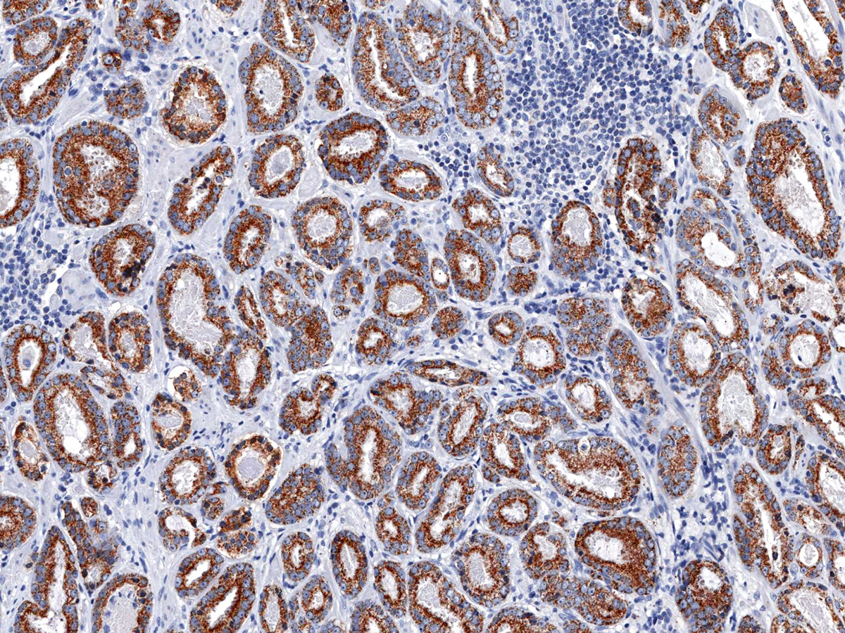 p504s Antibody