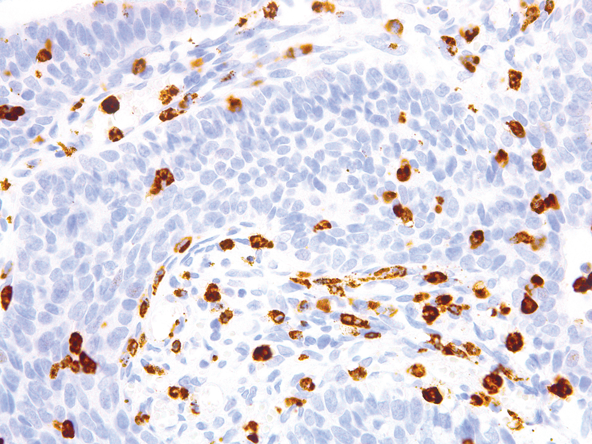 CD15/Leu-M1 Antibody