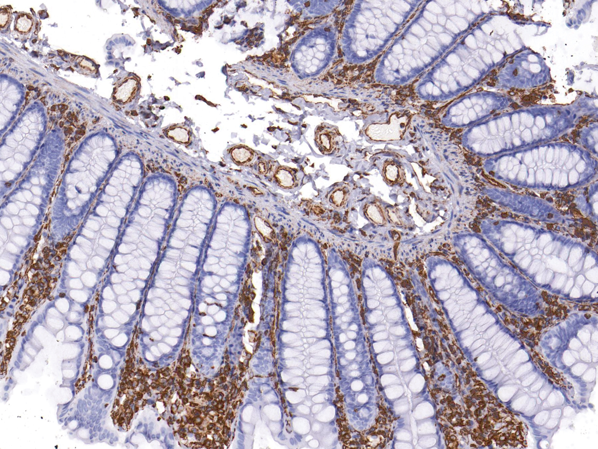 Vimetin Antibody