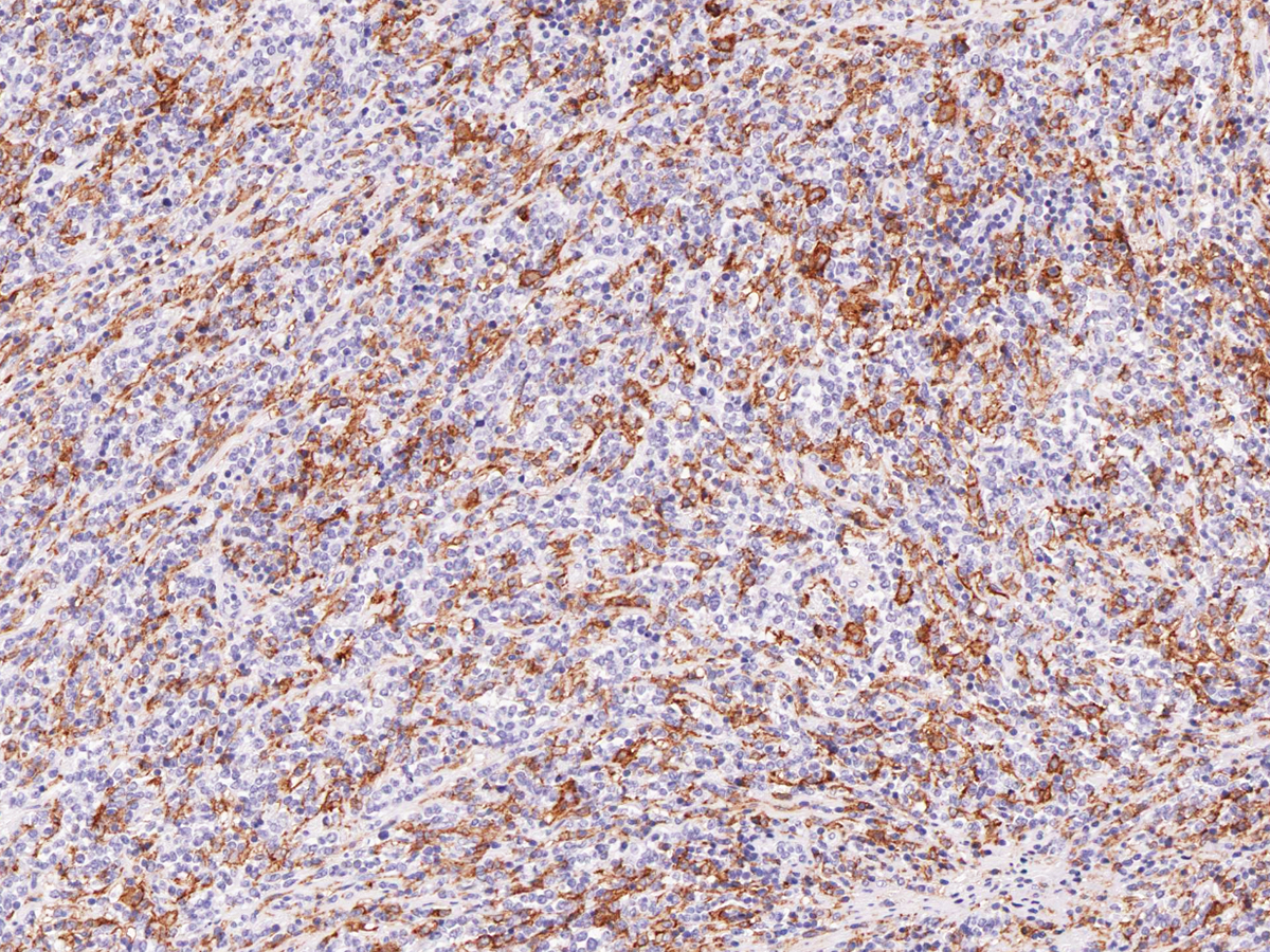 Hairy Cell Leukemia Antibody