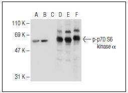 p70 S6 Kinase (Phospho-Ser 411) Antibody