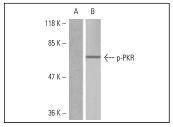 PKR (Phospho-Thr446) Antibody