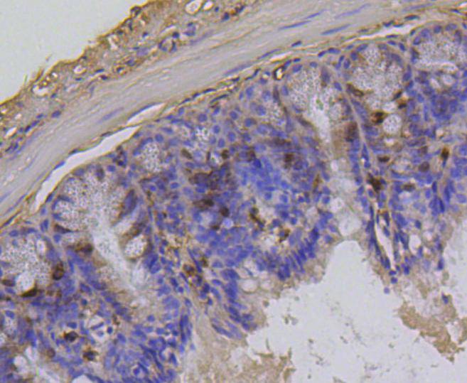 Phospho-Histone H1.3(T17)+Histone H1.4(T17) Rabbit mAb