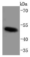 Phospho-c-Myc (T58+S62) Rabbit mAb