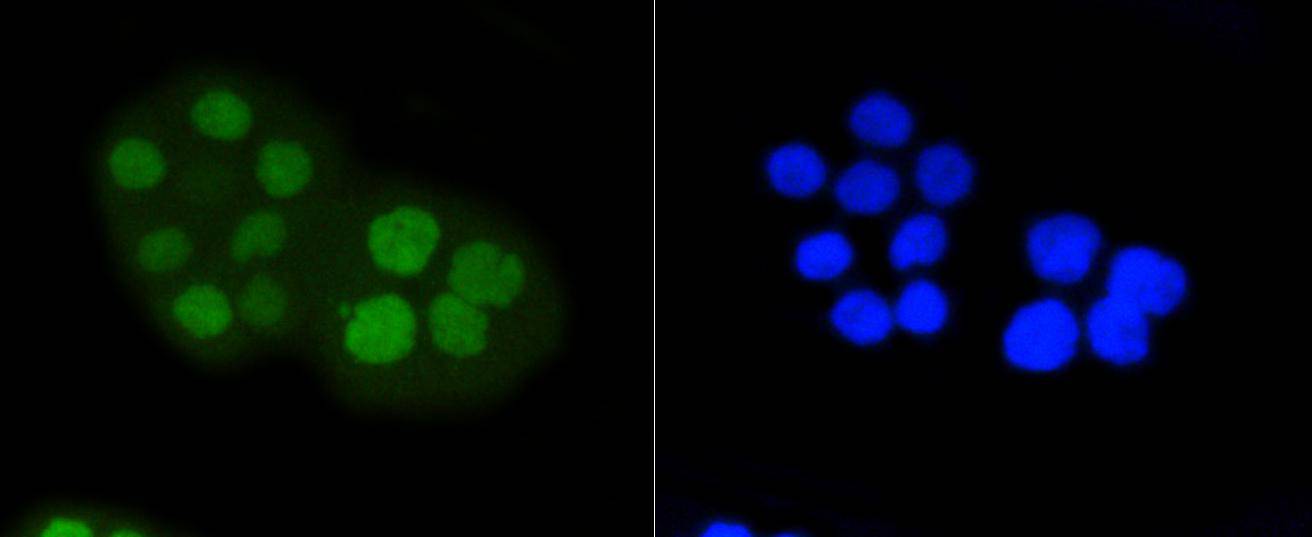 Phospho-Rb(S807) Rabbit mAb