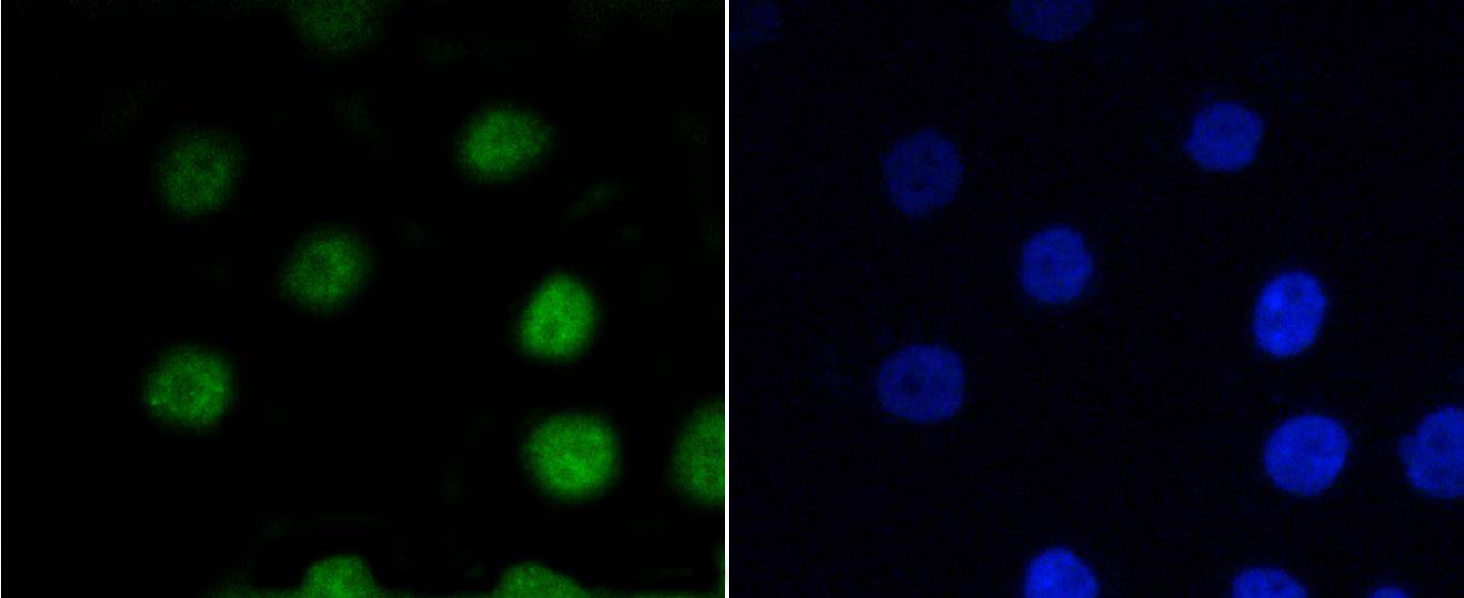 P-V-Myb+C-Myb(S11) Rabbit mAb