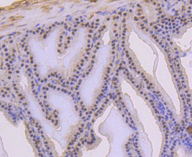 Phospho-p53(S392) Rabbit mAb