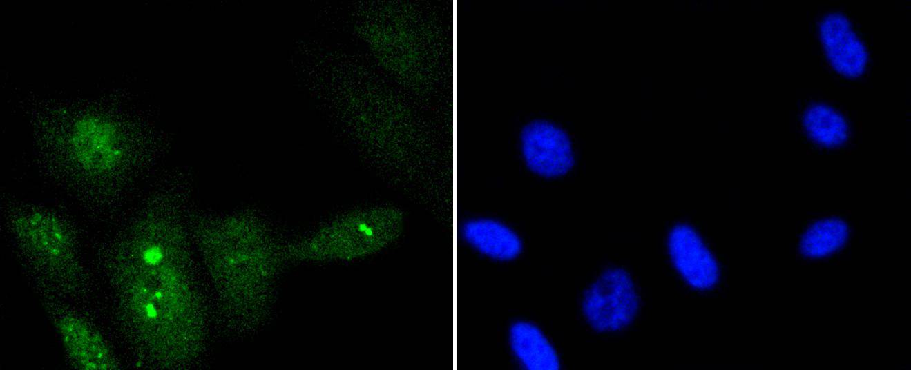 Phospho-p95/NBS1 (S343) Rabbit mAb