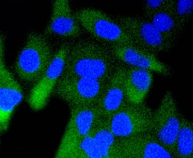 Phospho-GSK3 beta(Ser 9) Rabbit mAb