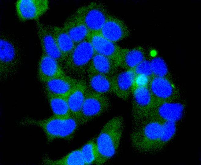 Phospho-GSK3 beta(Ser 9) Rabbit mAb