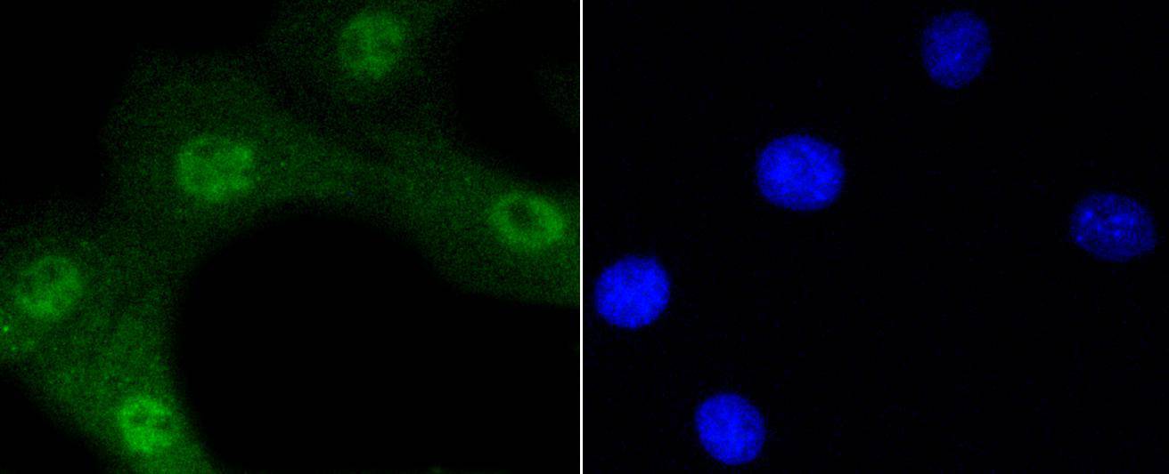 Phospho-Akt1(Ser473) Rabbit mAb