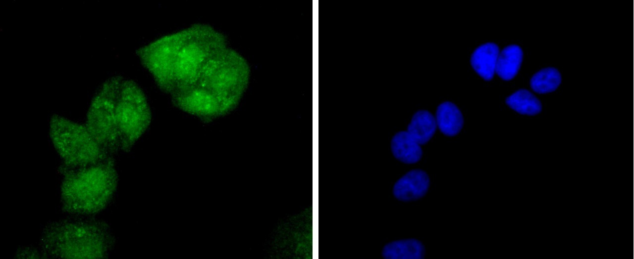 Phospho-HSF1(S326) Rabbit mAb