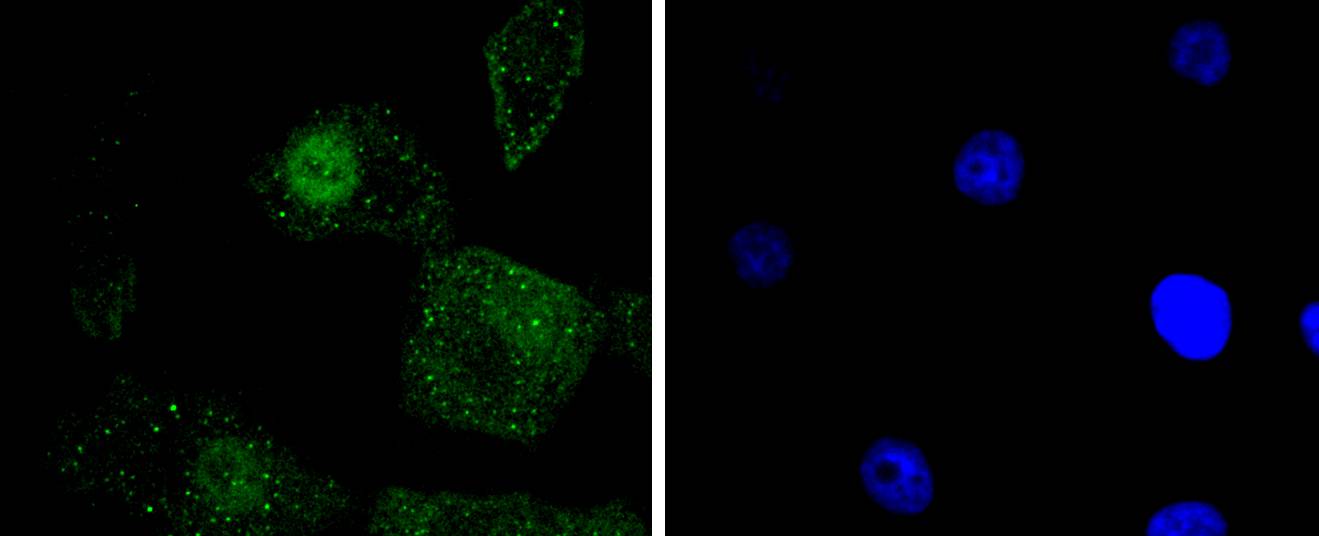 Phospho-c-Jun(S63) Rabbit mAb