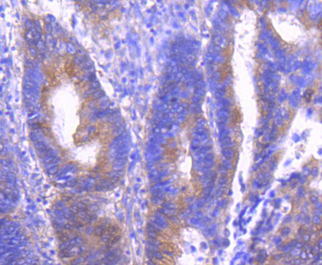 Phospho-PAK1(S144)+PAK2(S141)+PAK3(S139) Rabbit mAb