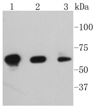 Phospho-PAK1(S144)+PAK2(S141)+PAK3(S139) Rabbit mAb