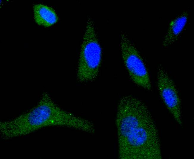 Phospho-eIF4E (S209) Rabbit mAb