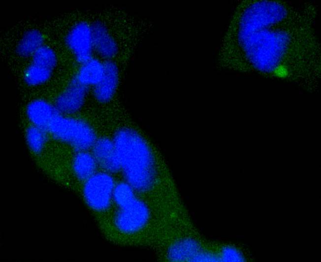 Phospho-eIF4E (S209) Rabbit mAb