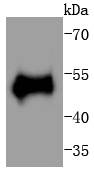 Phospho-p53 (T55) Rabbit mAb