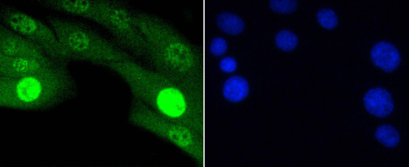 Phospho-JNK1/2/3(T183+T183+T221) Rabbit mAb