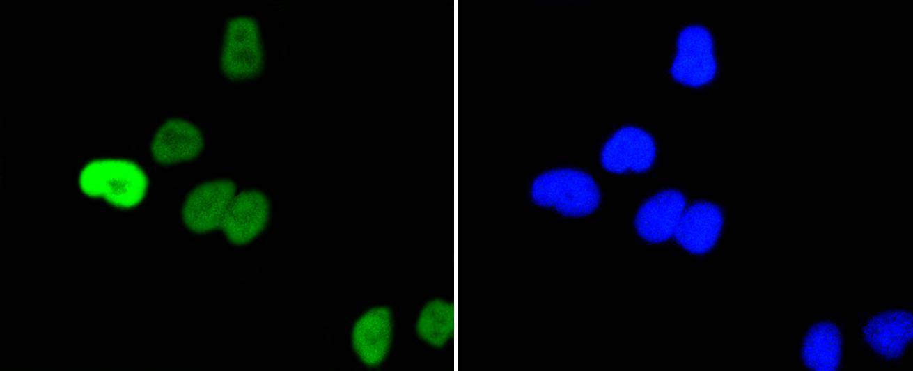 Phospho-c-Myc(S62) Rabbit mAb