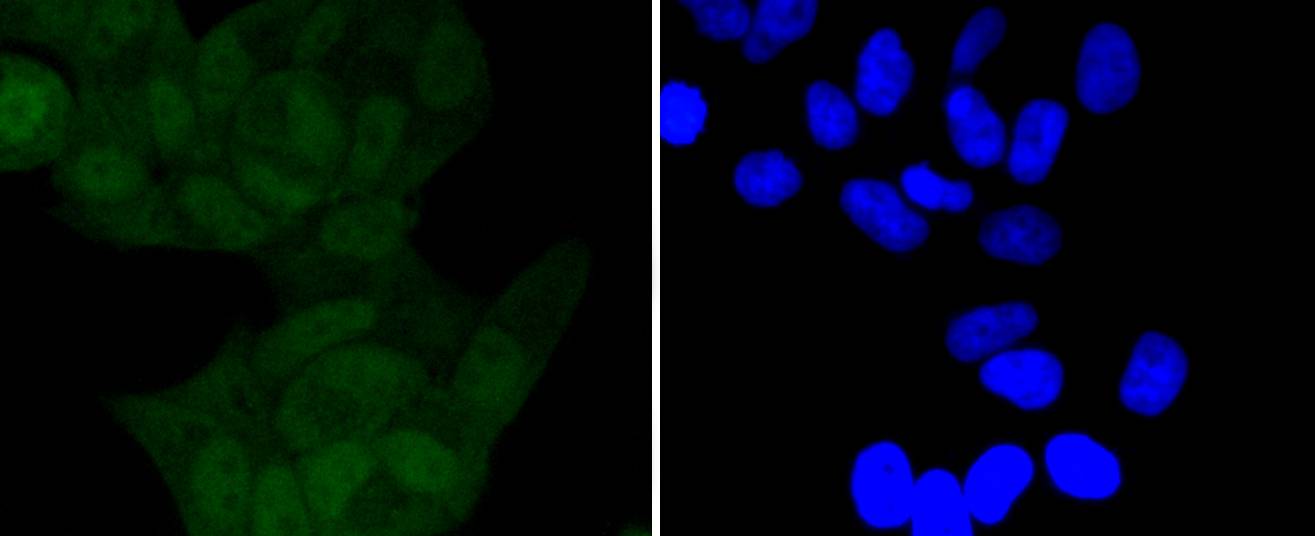 Phospho-IKB alpha(S32) Rabbit mAb