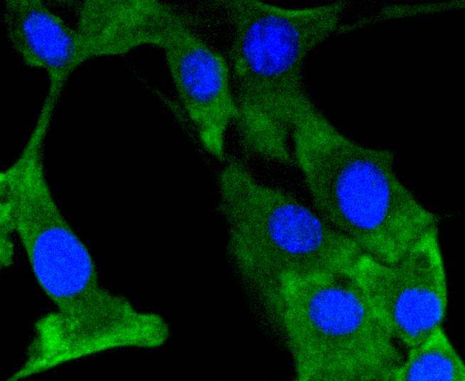 Phospho-FAK (Y397) Rabbit mAb