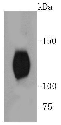 Phospho-TrkB(Y817) Rabbit mAb