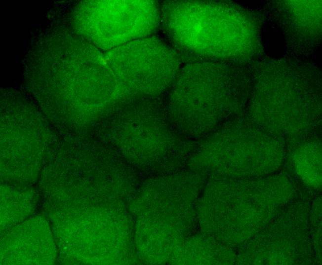 Phospho-EGFR (pY1173) Rabbit mAb