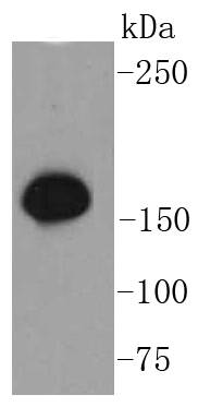 Phospho-SMC1(S957) Rabbit mAb