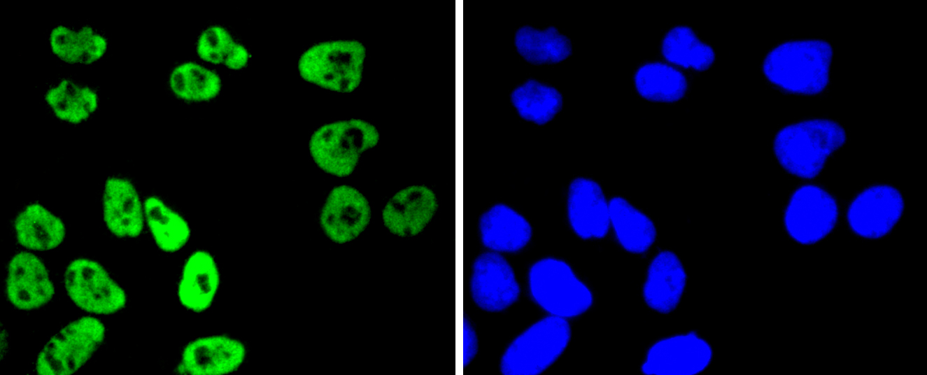 MSK1(phospho S376) Rabbit mAb