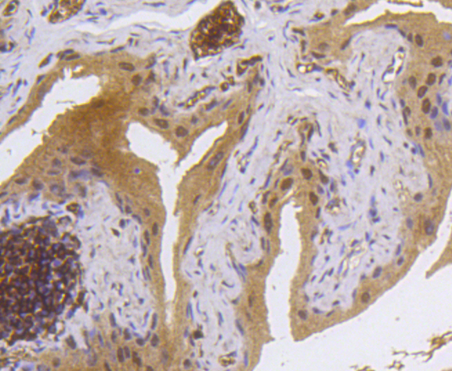 MSK1(phospho S376) Rabbit mAb