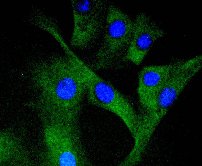 Phospho-MEK1 (S298) Rabbit mAb