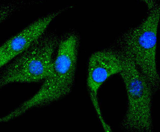 Phospho-Hsp27(S78) Rabbit mAb