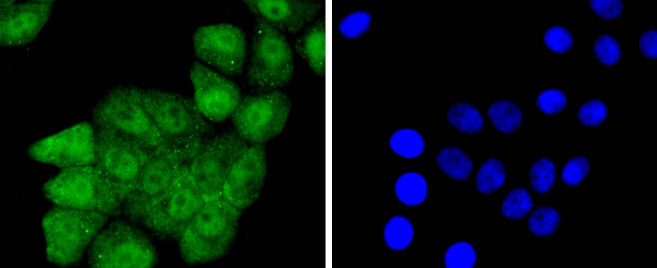 Phospho-JunD(S255) Rabbit mAb