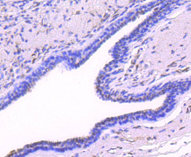 Phospho-JunD(S255) Rabbit mAb