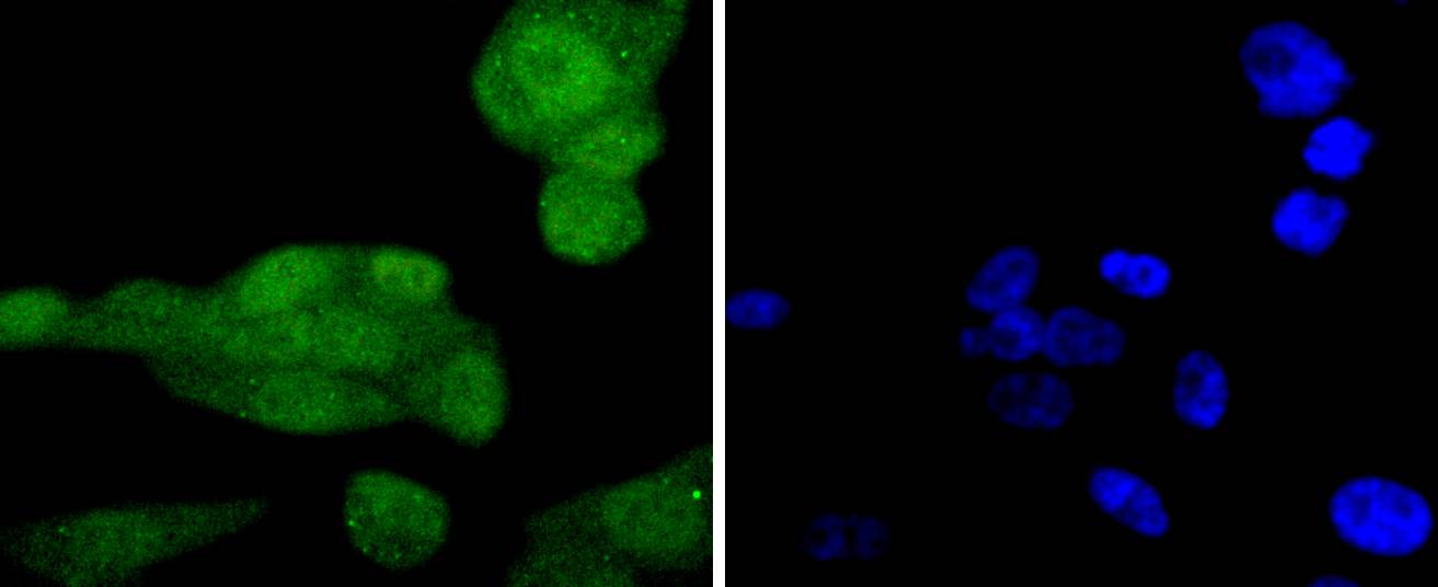 Phospho-AKT1(S124) Rabbit mAb