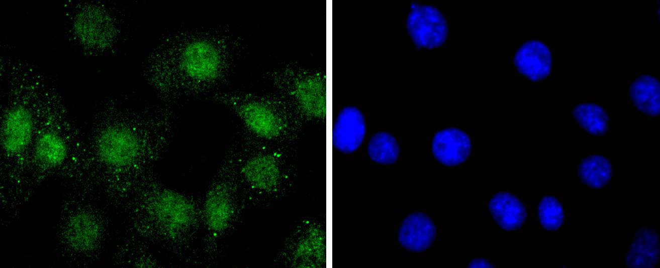 Phospho-AKT1(S124) Rabbit mAb