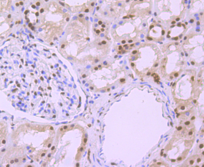 Phospho-alpha Synuclein (S129) Rabbit mAb