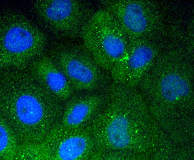 Vitronectin Rabbit mAb