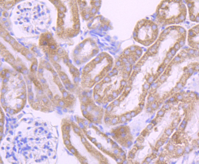 Cytochrome P450 17A1 Rabbit mAb