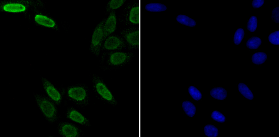 U1A Rabbit mAb