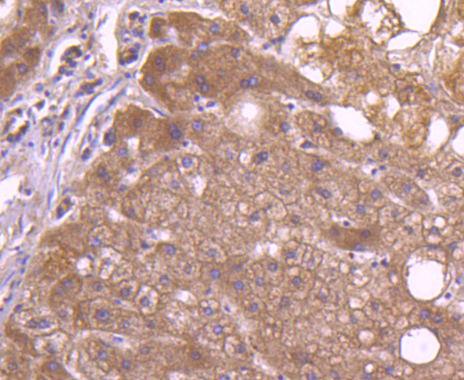 TAPA1/CD81 Rabbit mAb