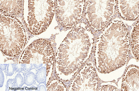 PCNA Mouse Monoclonal Antibody