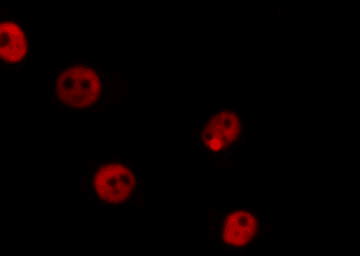 MDM2(Ab-166) Antibody